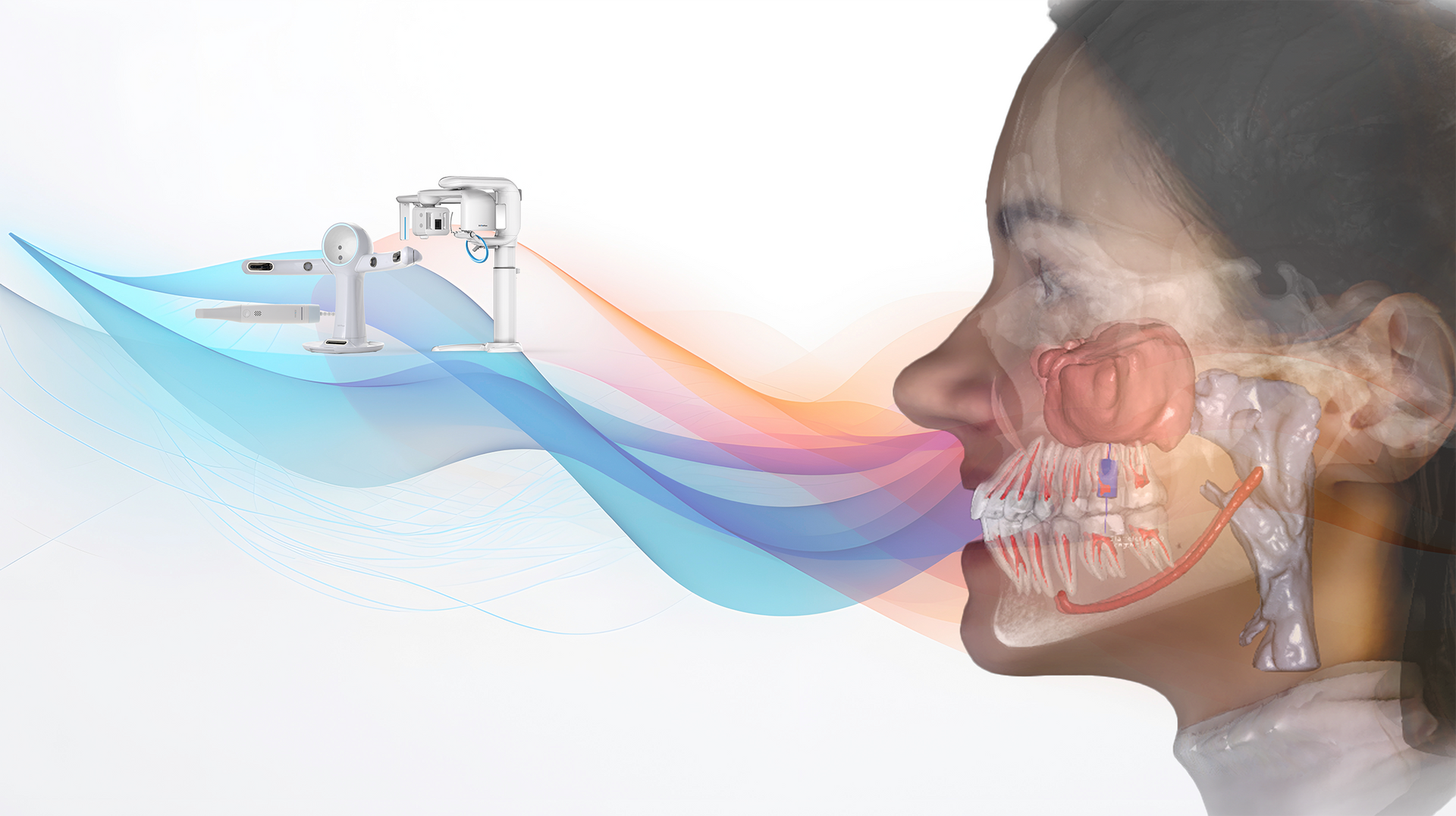 RAYFace Datenfusion aus Face Scan, IOS und DVT