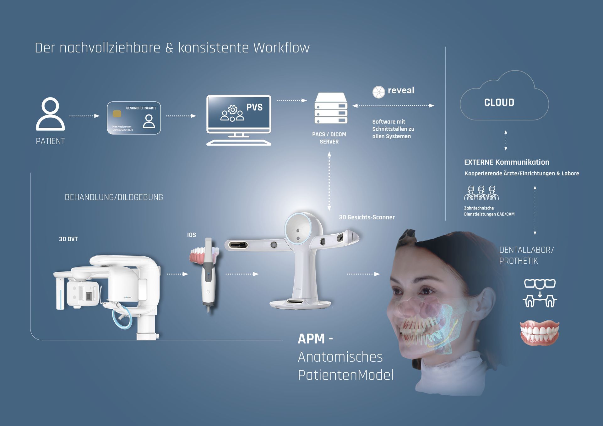 reveal-Software im digitalen Prozess