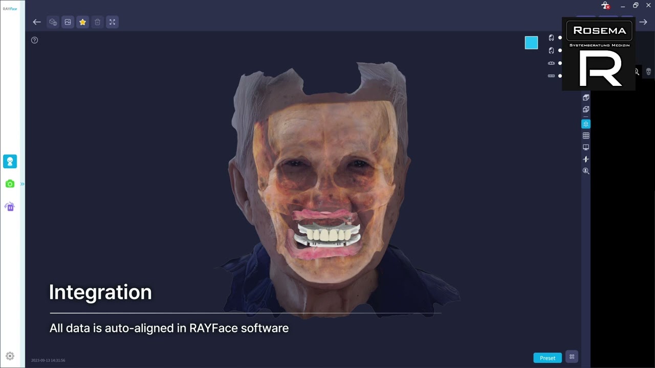 RAY etray Verfahren