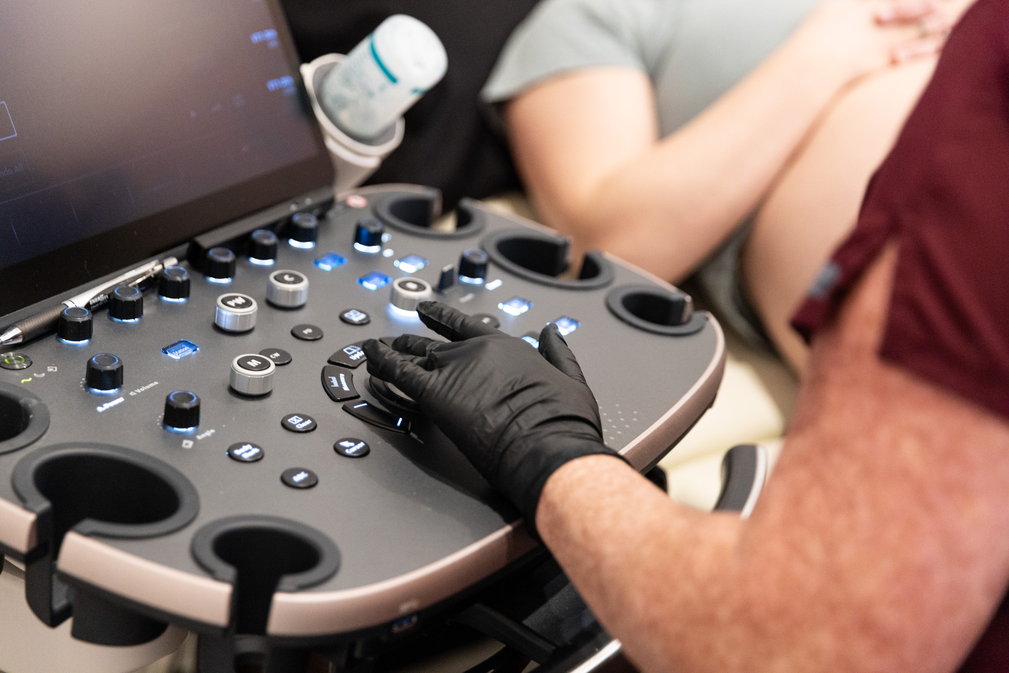 ultrasound machine ultrasound machine