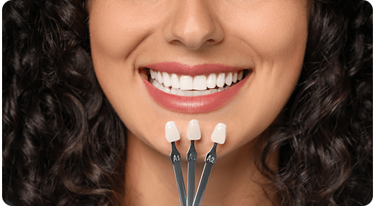 Dental Veneers