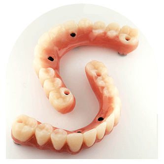 1000’s of Dental Implants Placed