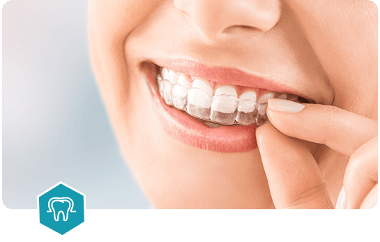 Wisdom Teeth Extractions