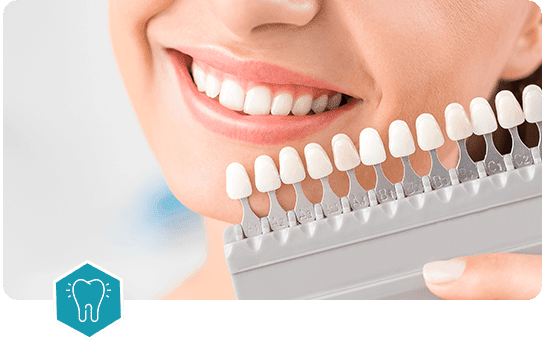 Dental Veneers