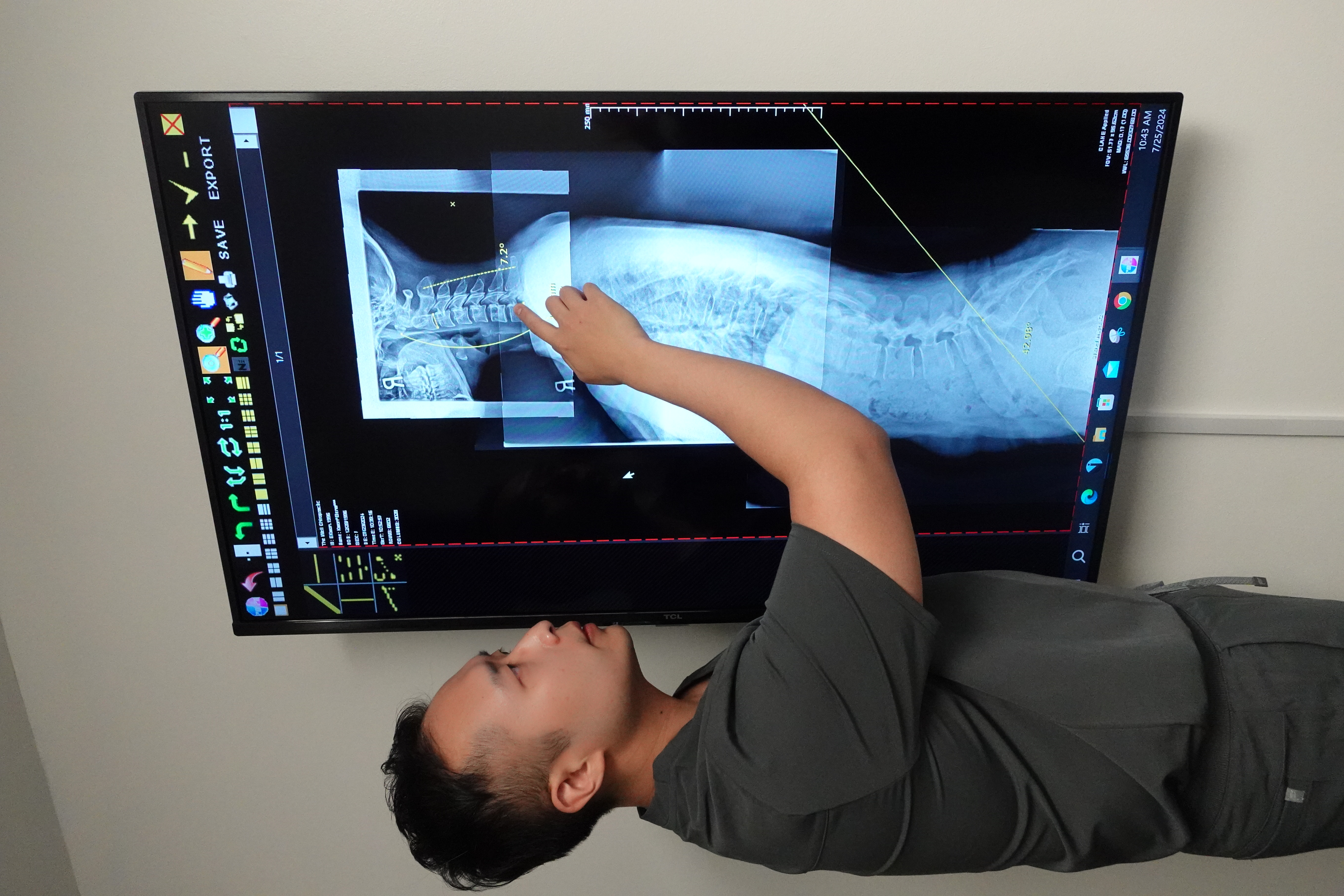 chiropractor in los angeles