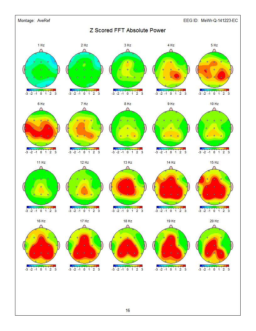 Brain neurofeedback process