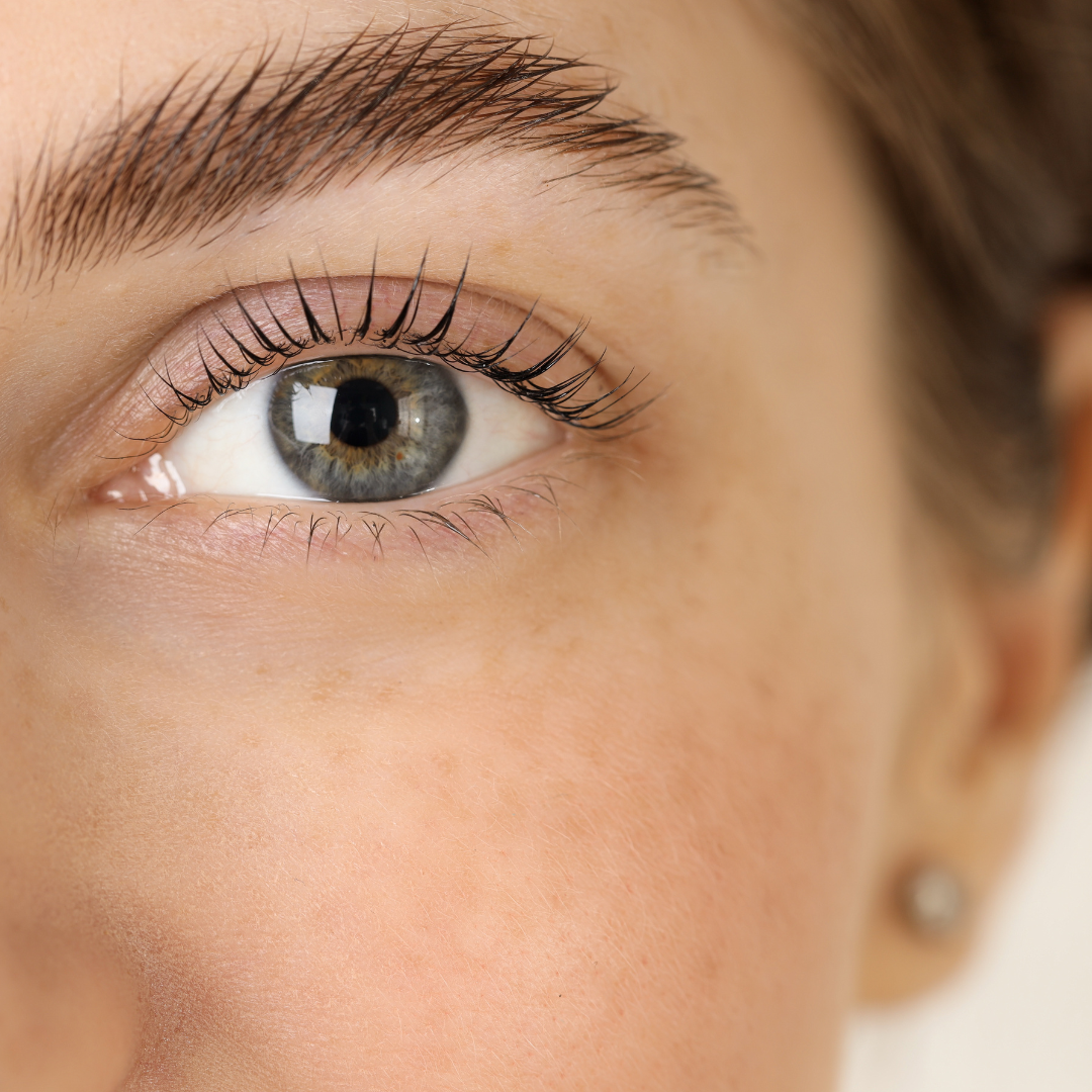 Brow Lift
