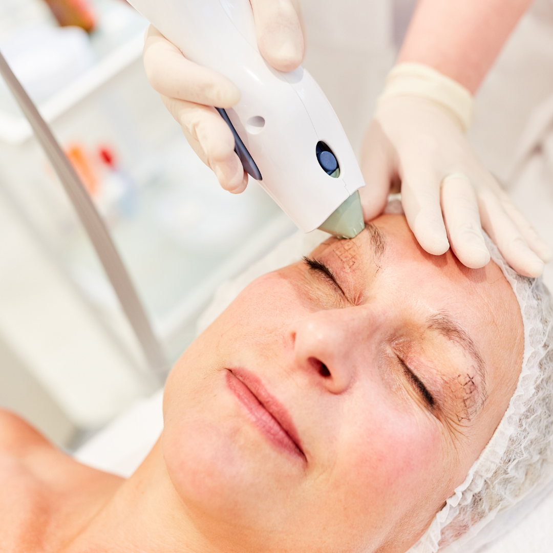 TriPollar RF Skin Tightening