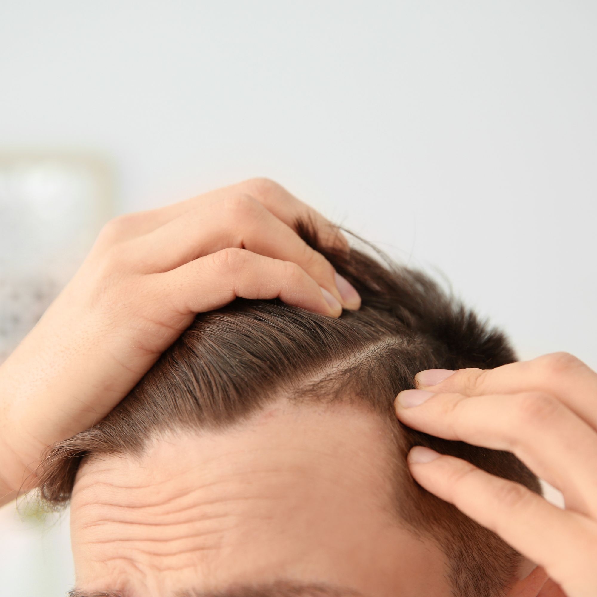 Scalp Treatment