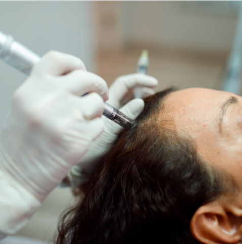 Scalp microneedling treatment at The Skin Edit