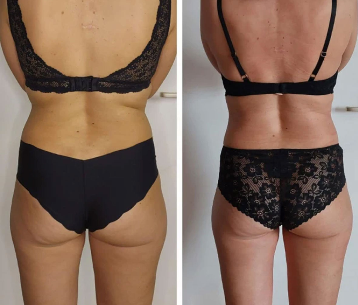 AiL Steyr - Vorher/Nachher 1