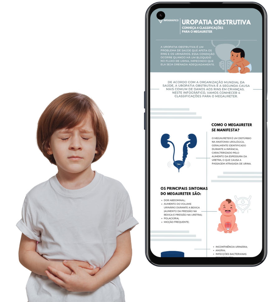 Uropatia obstrutiva