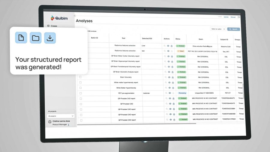 Interfaz de la plataforma QP-Insights de Quibim
