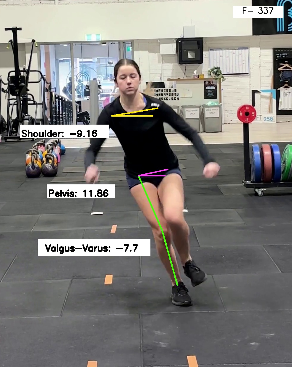 Prepared to Play ACL Rehabilitation Program — Stride Sports Physio