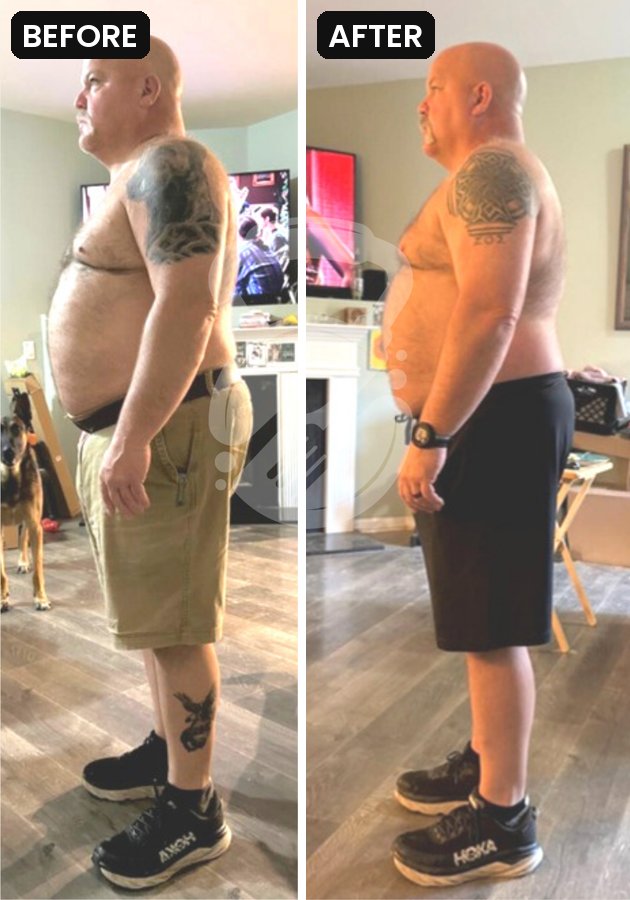 Rodney R. before and after