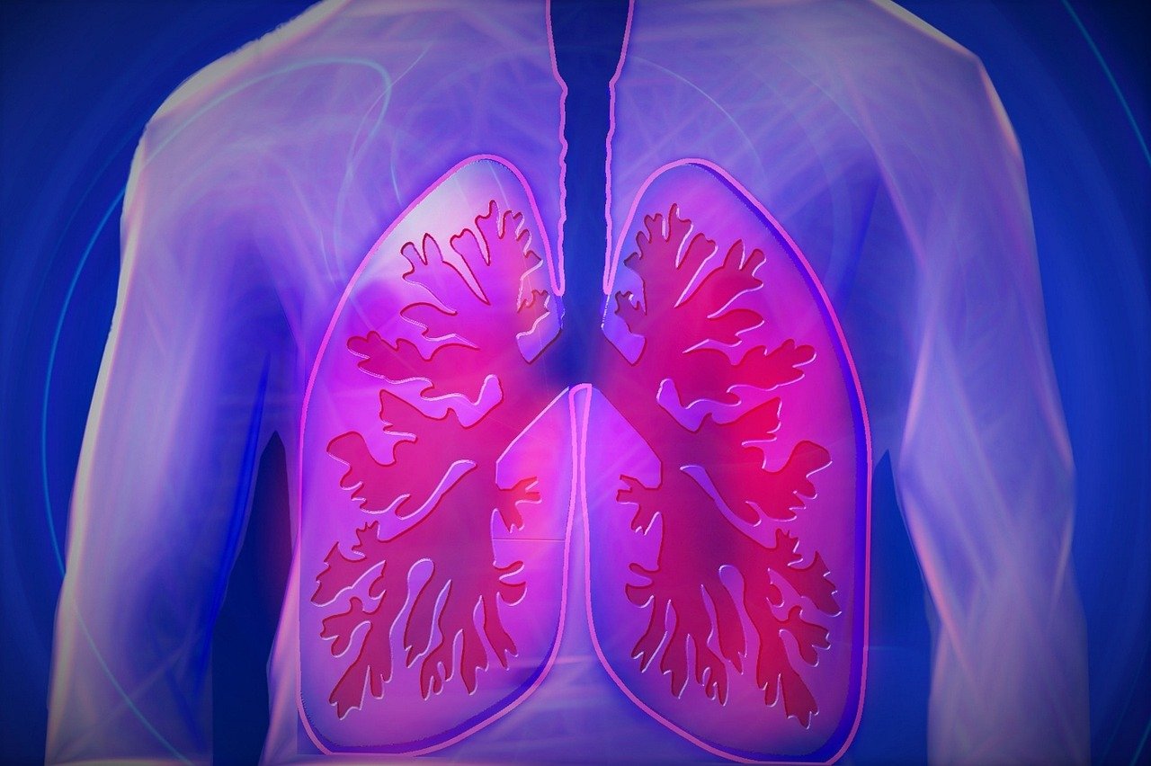 Understanding Lung Disease: A Patient's Guide