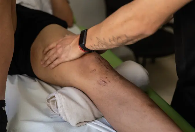 Kinesiología pre y post operatorio