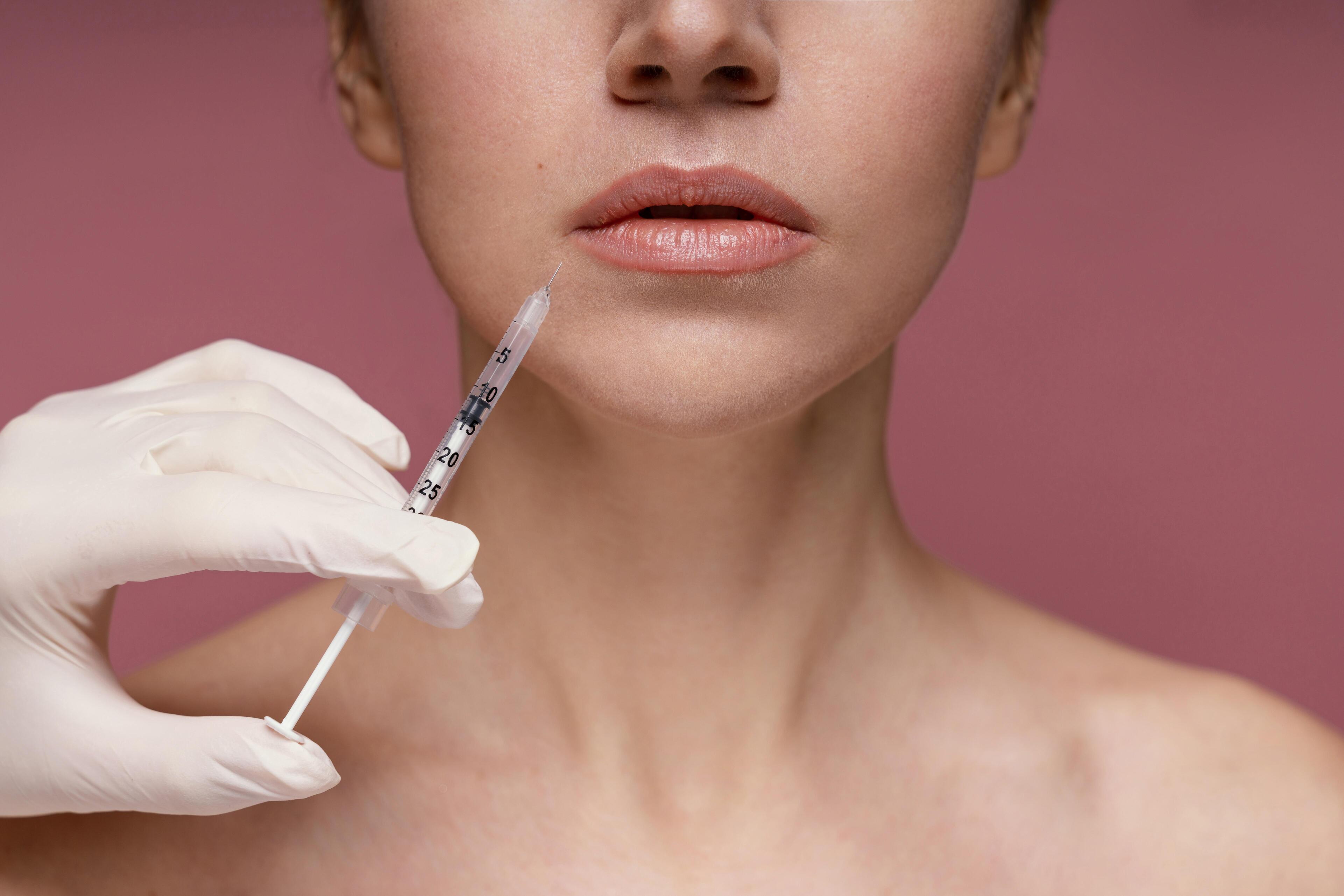 Dermal Fillers