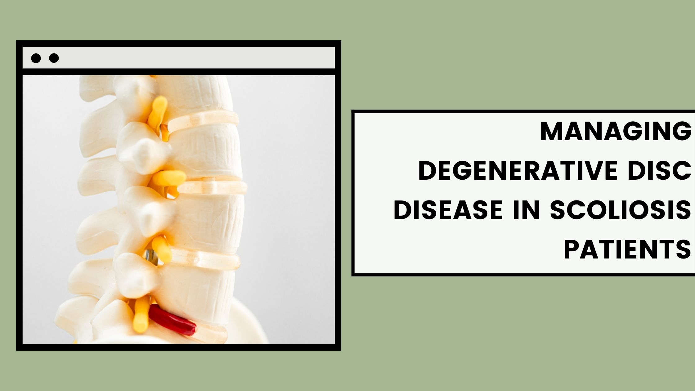 Managing Degenerative Disc Disease In Scoliosis Patients Exercises For Relief