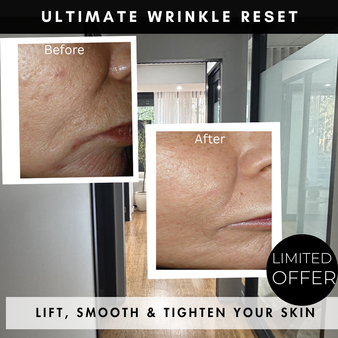 iPixel device at Dr Mandi Cosmetic Skin Clinic