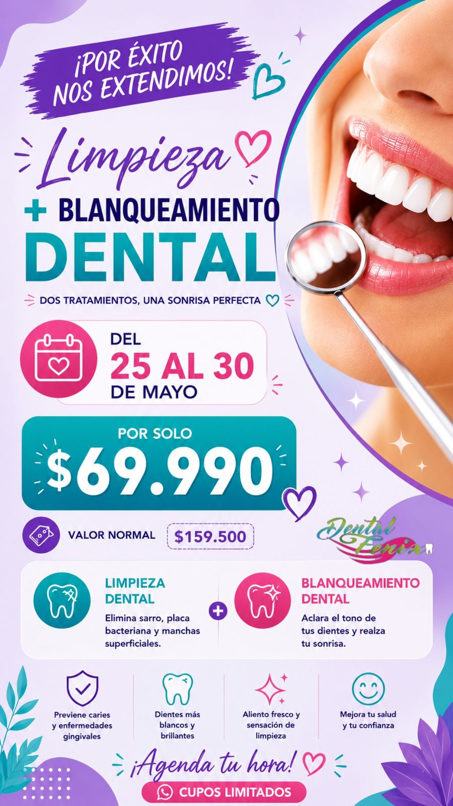 Promoción extendida por éxito del 25 al 30 de mayo: Limpieza más Blanqueamiento Dental por $69.990 (valor normal $159.500). Incluye prevención de caries y enfermedades gingivales, dientes más blancos y brillantes, aliento fresco, sensación de limpieza, y mejora en tu salud y confianza. Cupos limitados.