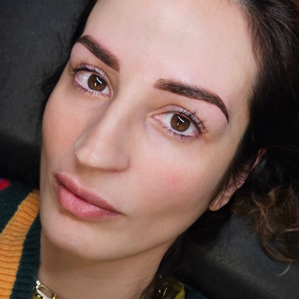 Pigmentation pr&eacute;cise