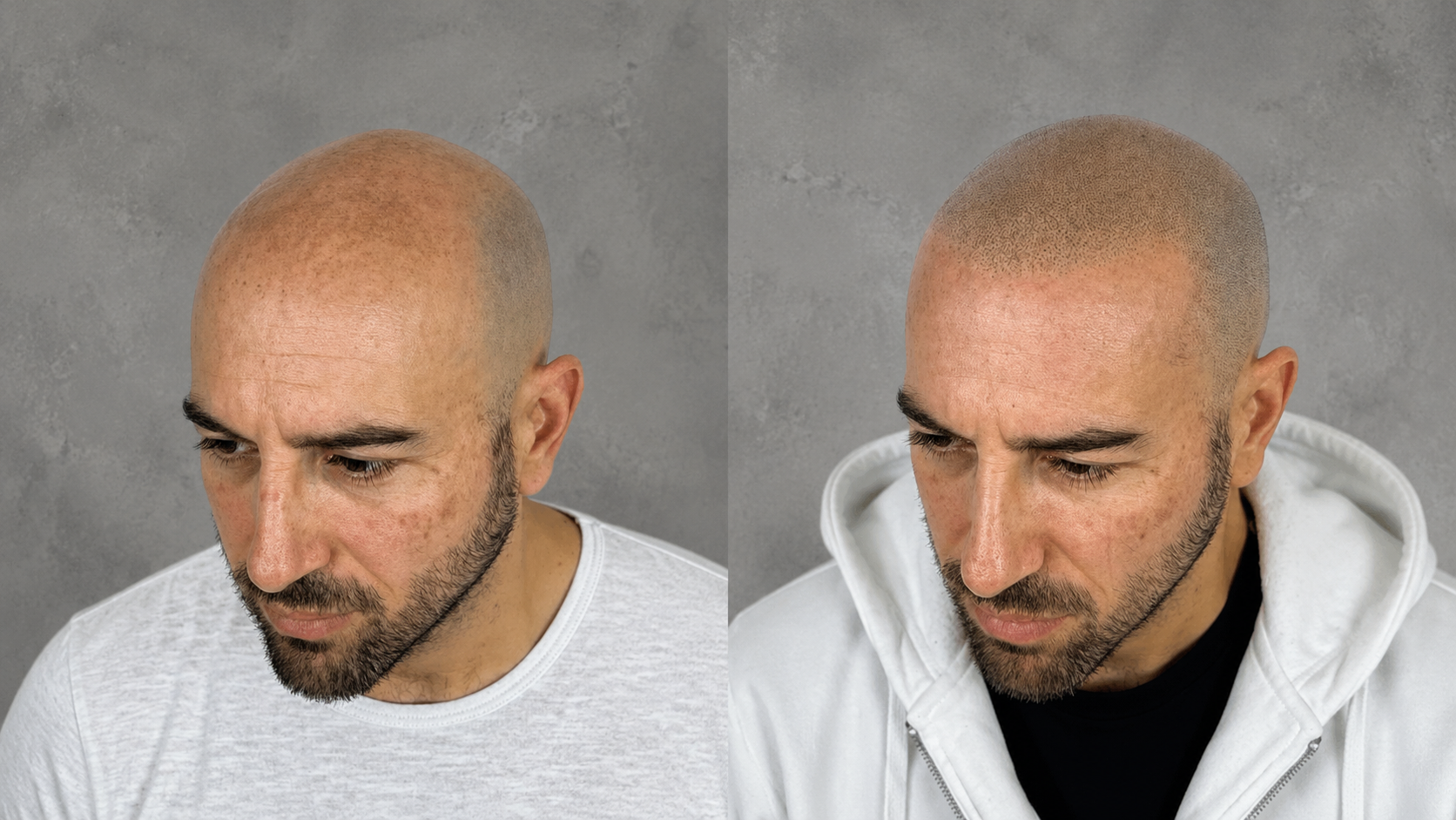 Résultat 1