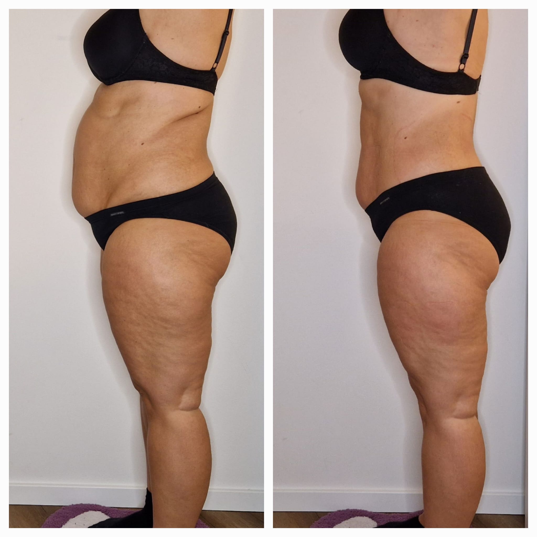 Vorher-Nachher Ergebnis 10