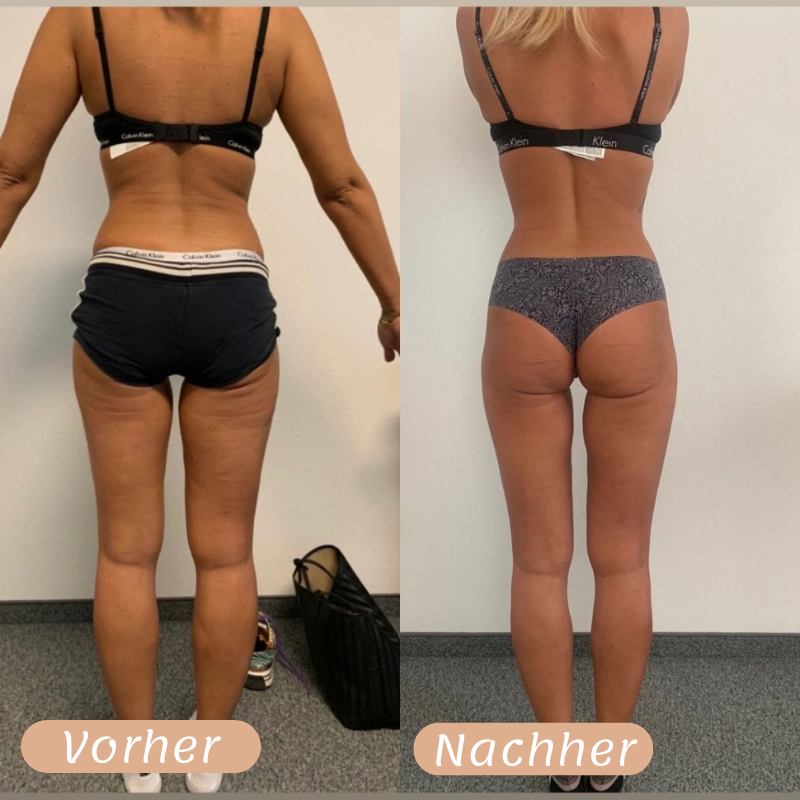 Vorher-Nachher Ergebnis 9