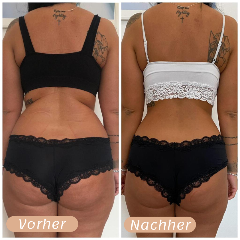 Vorher-Nachher Ergebnis 6