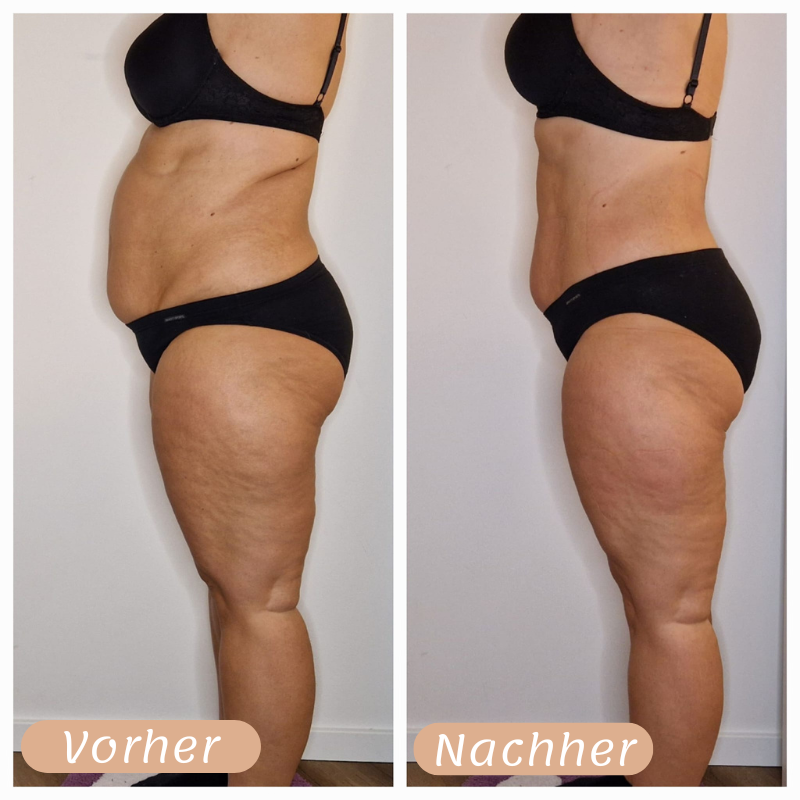 Vorher-Nachher Ergebnis 7