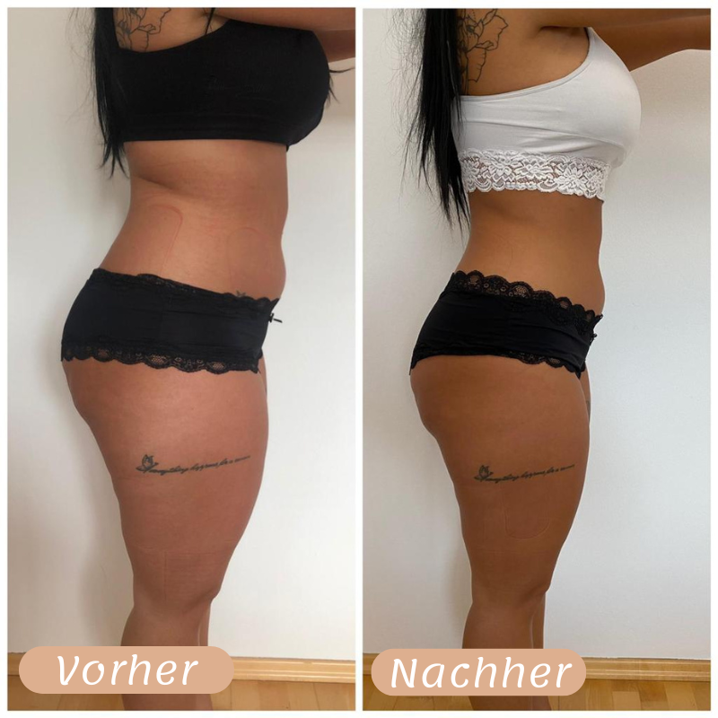 Vorher-Nachher Ergebnis 8