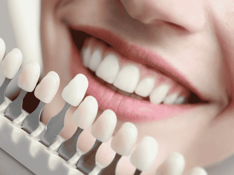 teeth being measured for its whiteness teeth being measured for its whiteness