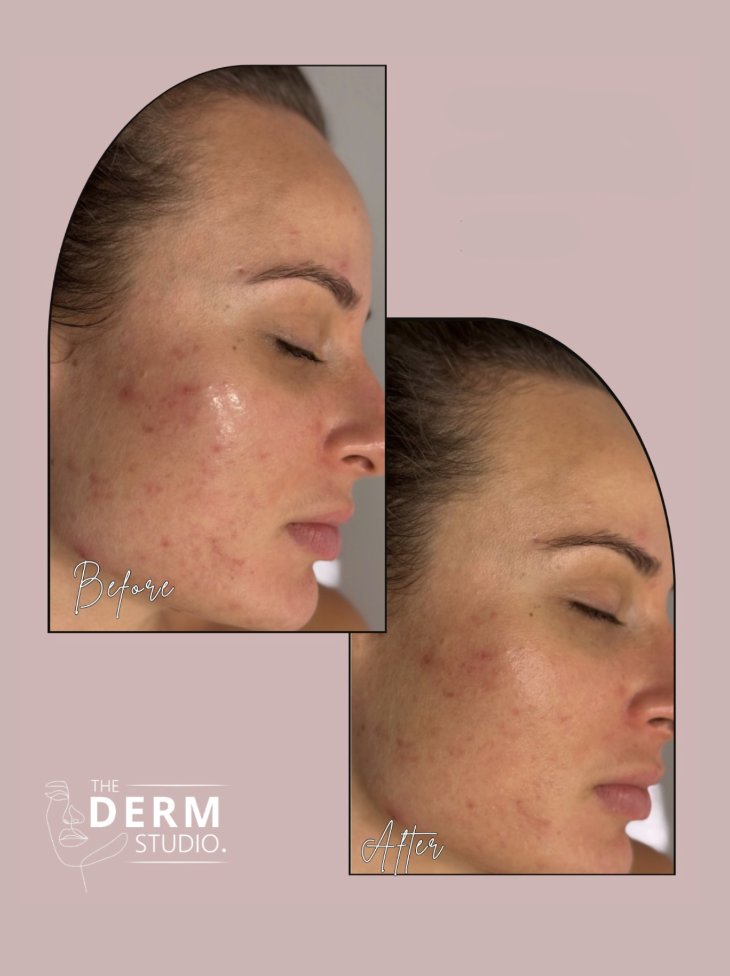 Before and After 1