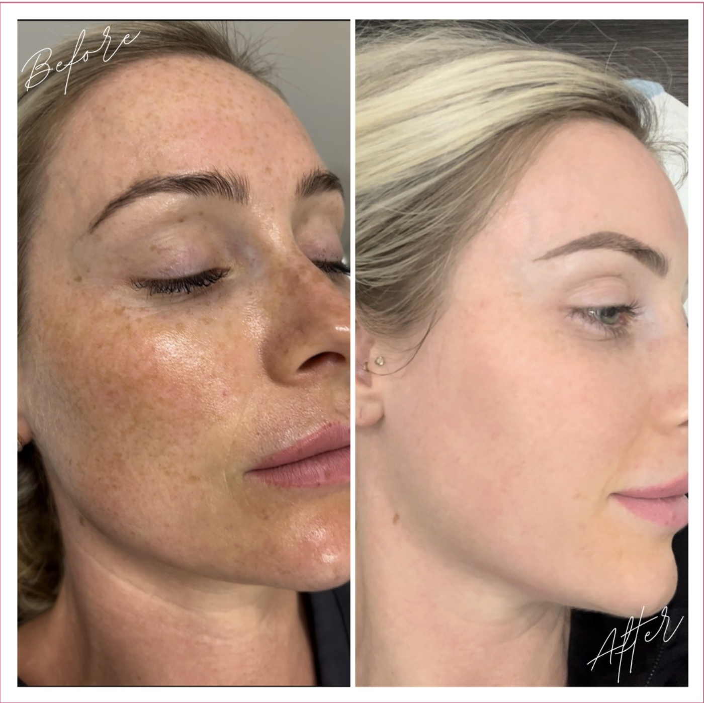 Skin result 1