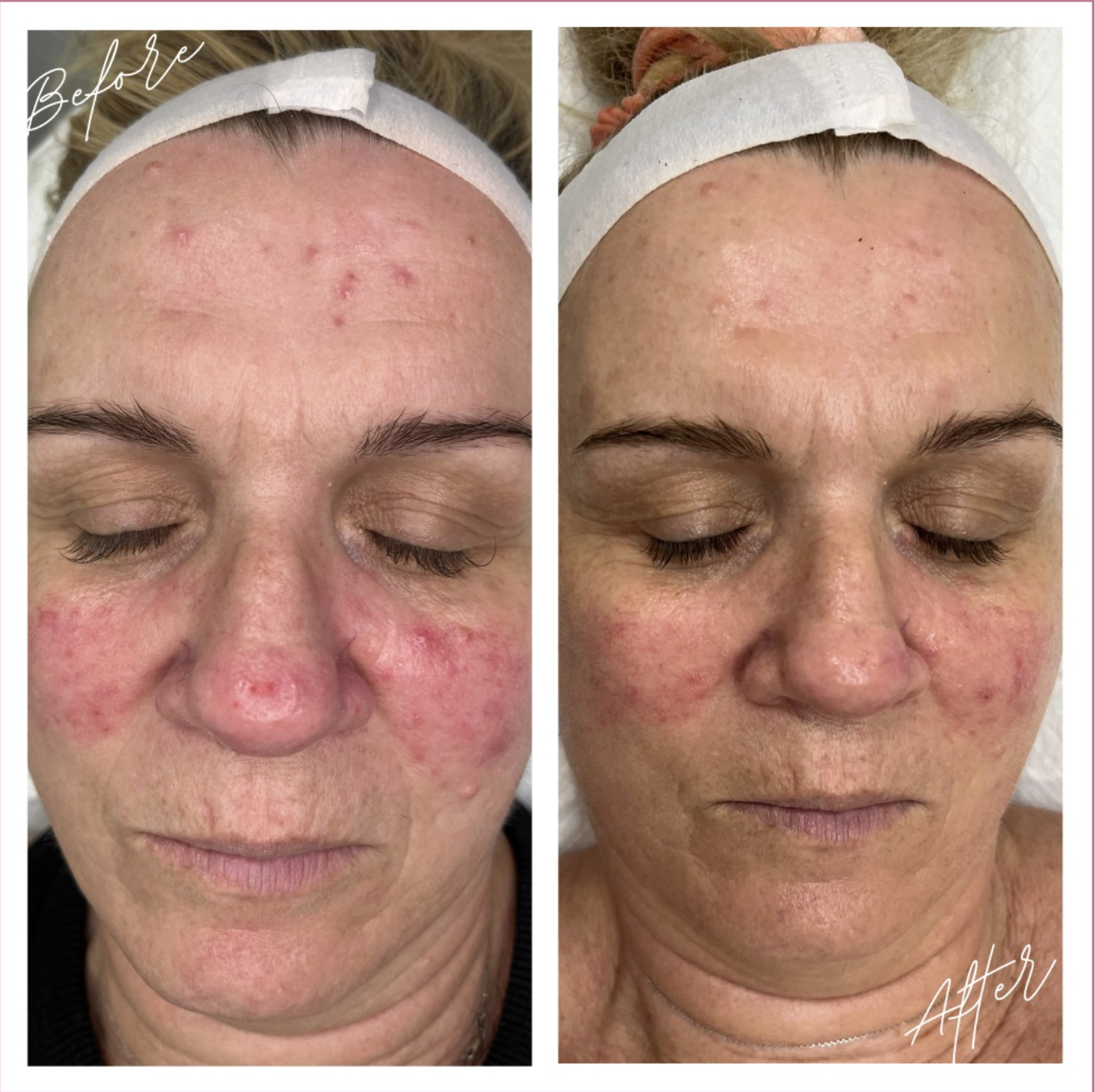 Before and After 2