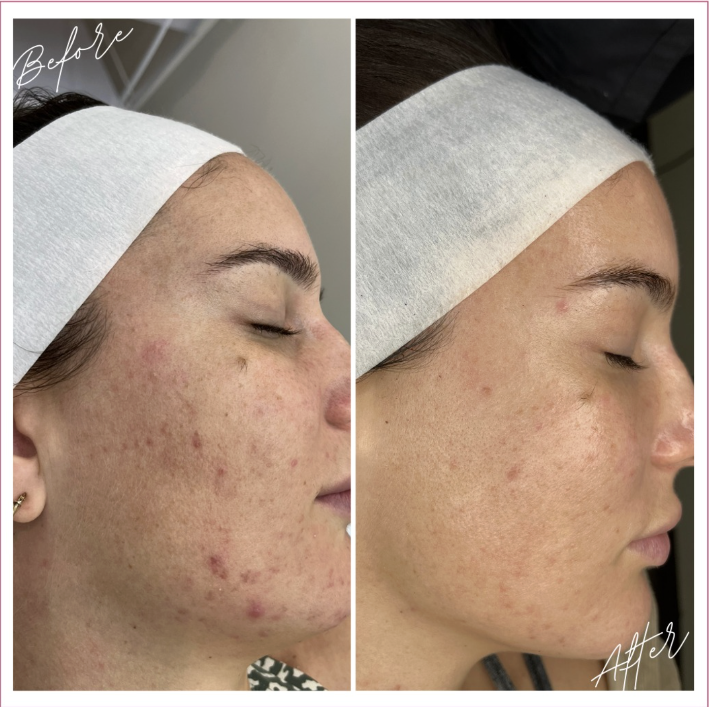 Skin result 3