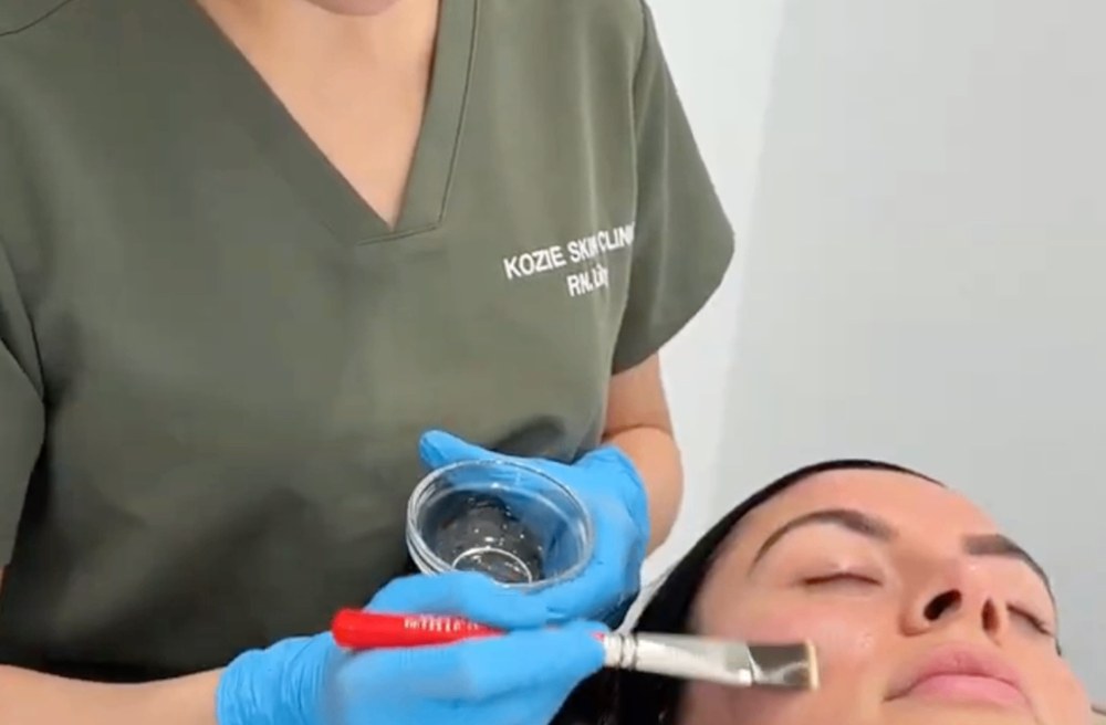 Registered nurse applying an Express LHALA Peel to a client's face
