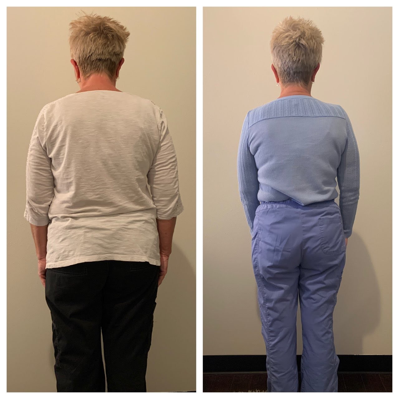 Client before and after results