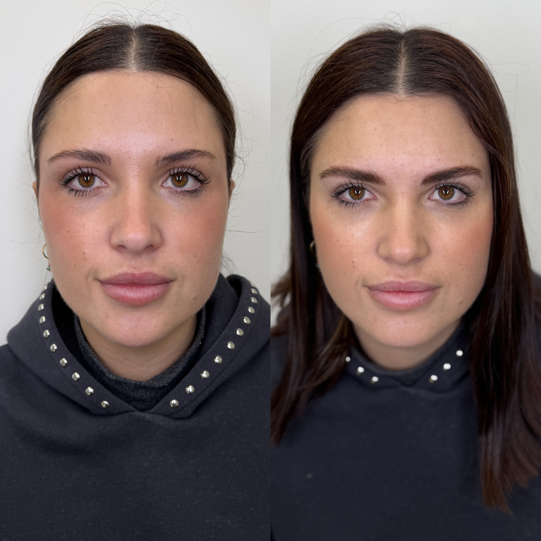 Antes y después micropigmentación 5