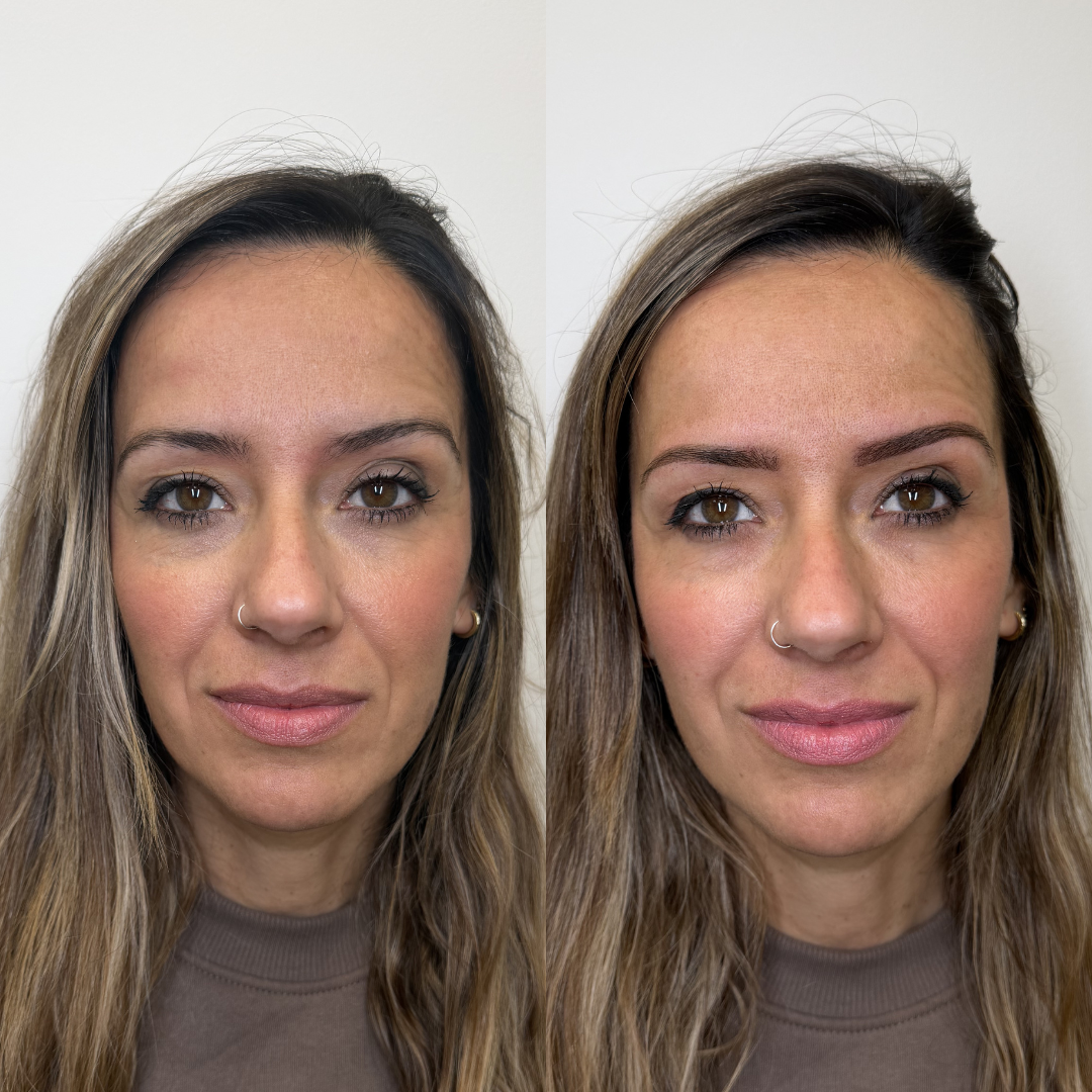 Antes y después micropigmentación 2