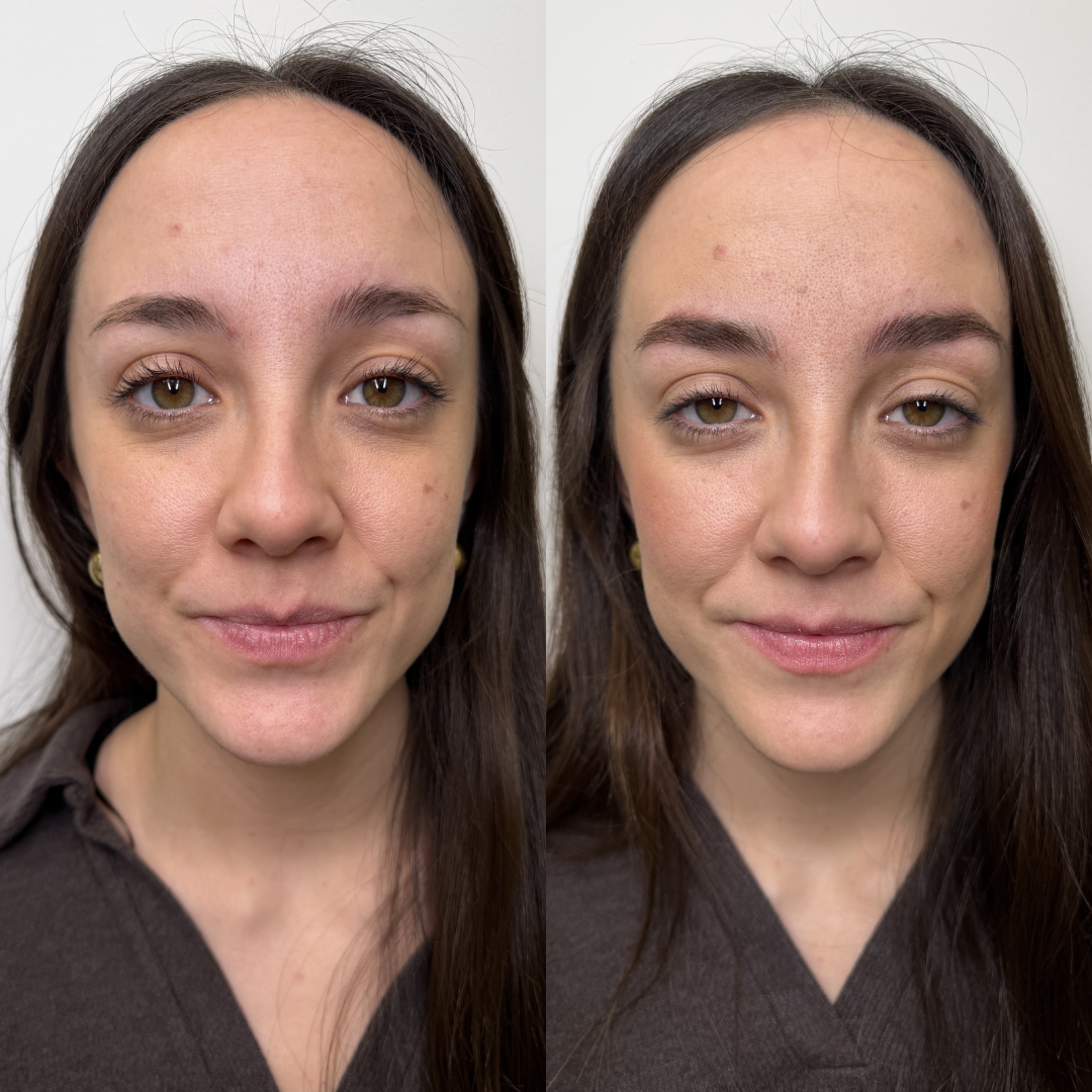 Antes y después micropigmentación 4