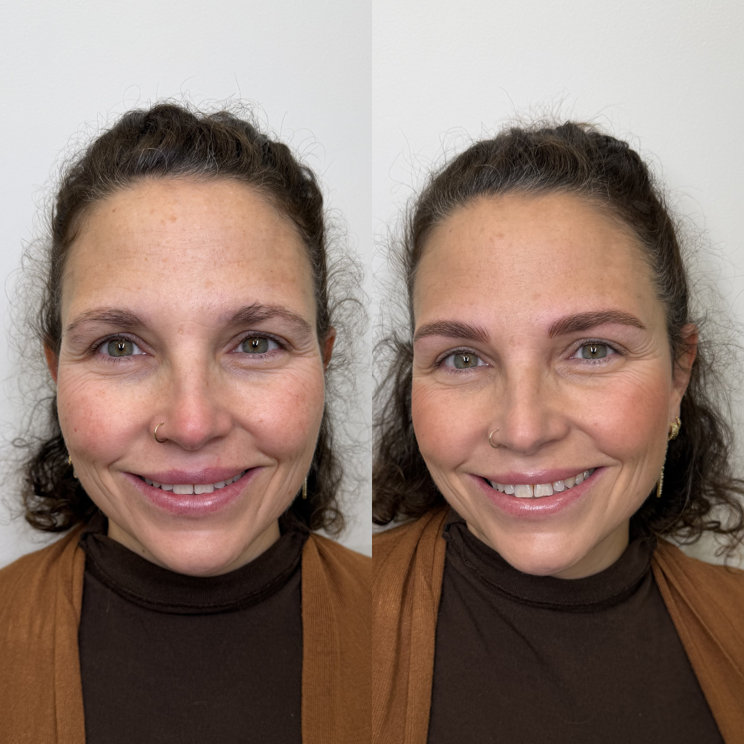 Antes y después micropigmentación 3