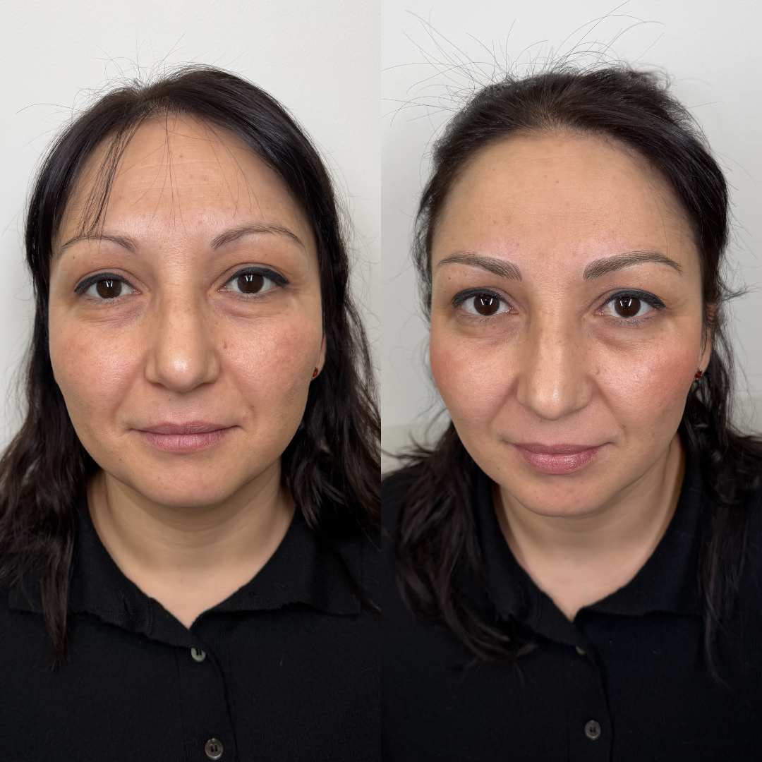 Antes y después micropigmentación 1
