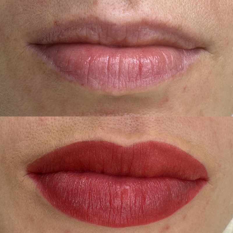 Antes y después micropigmentación de labios 2