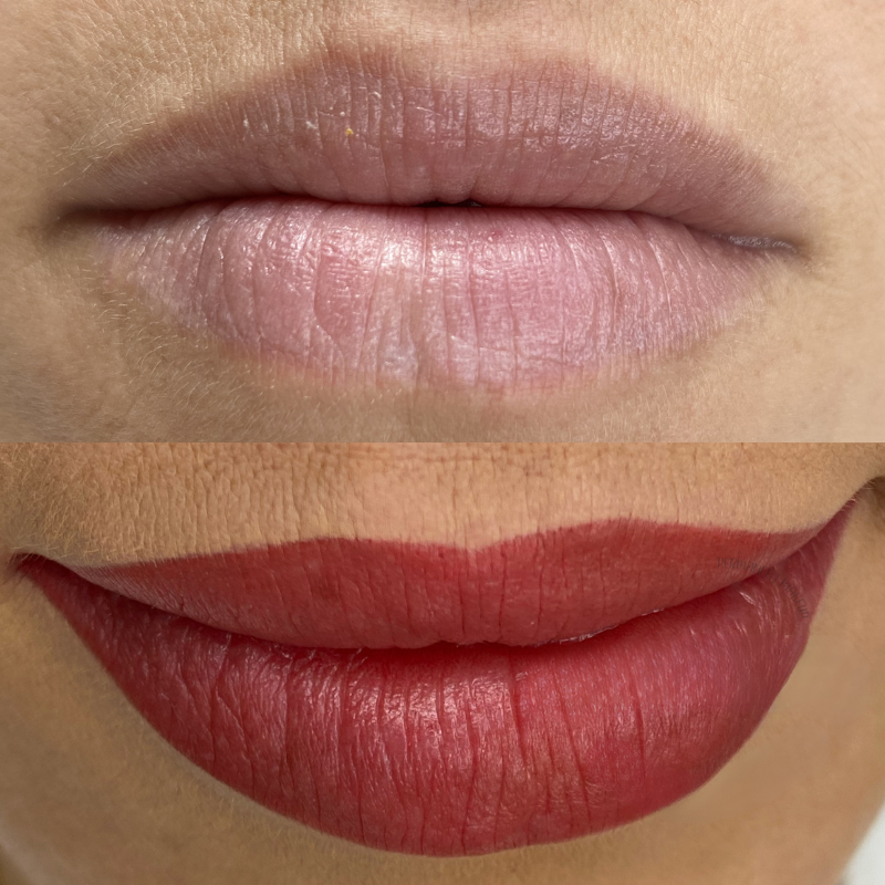 Antes y después micropigmentación de labios 3