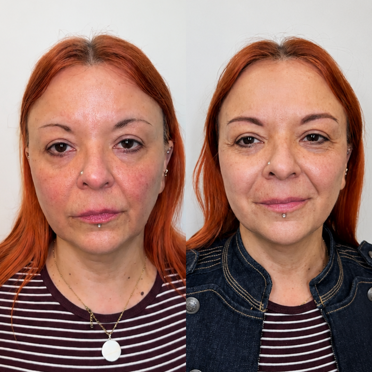 Antes y después micropigmentación de cejas, clienta 2