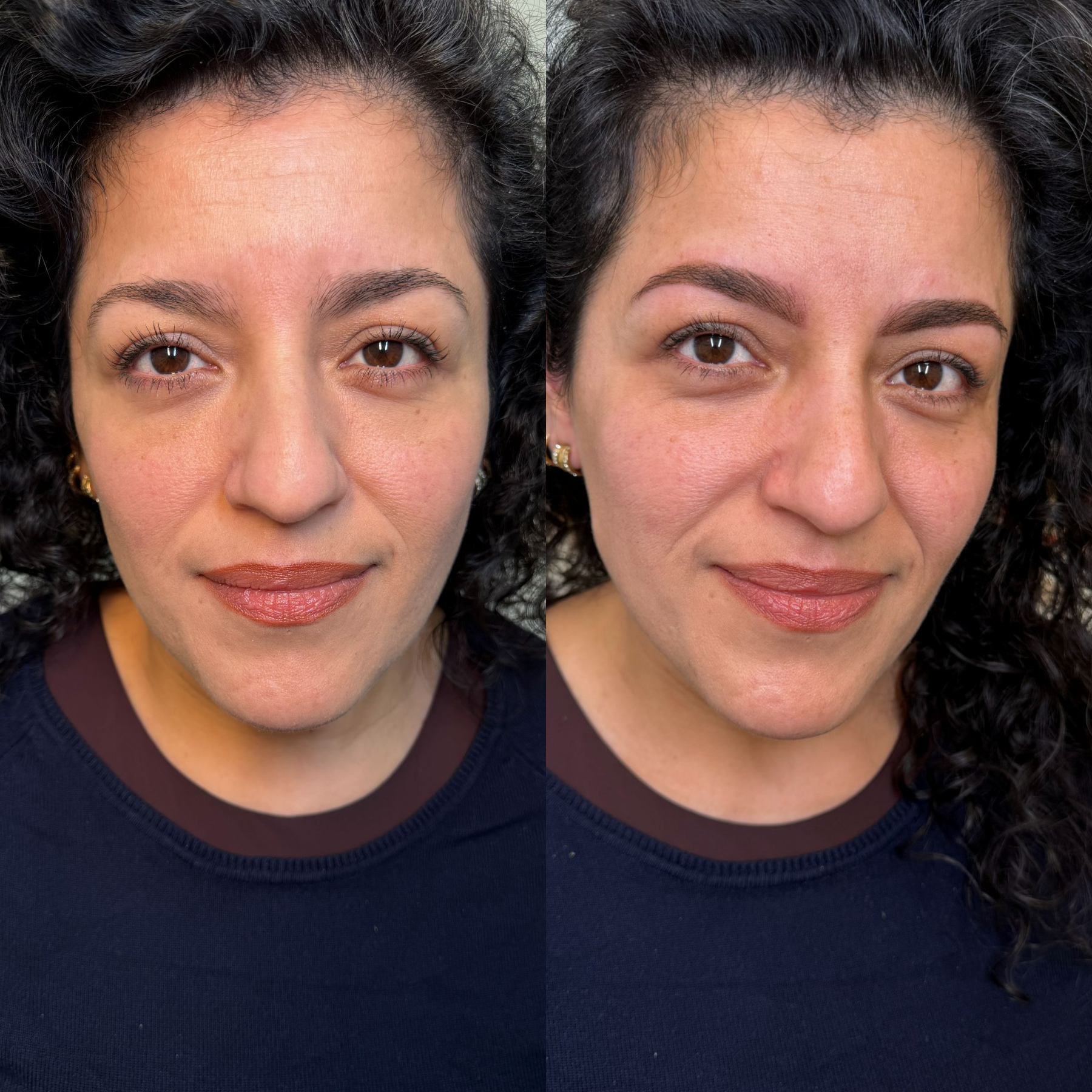 Antes y después micropigmentación de cejas, clienta 4