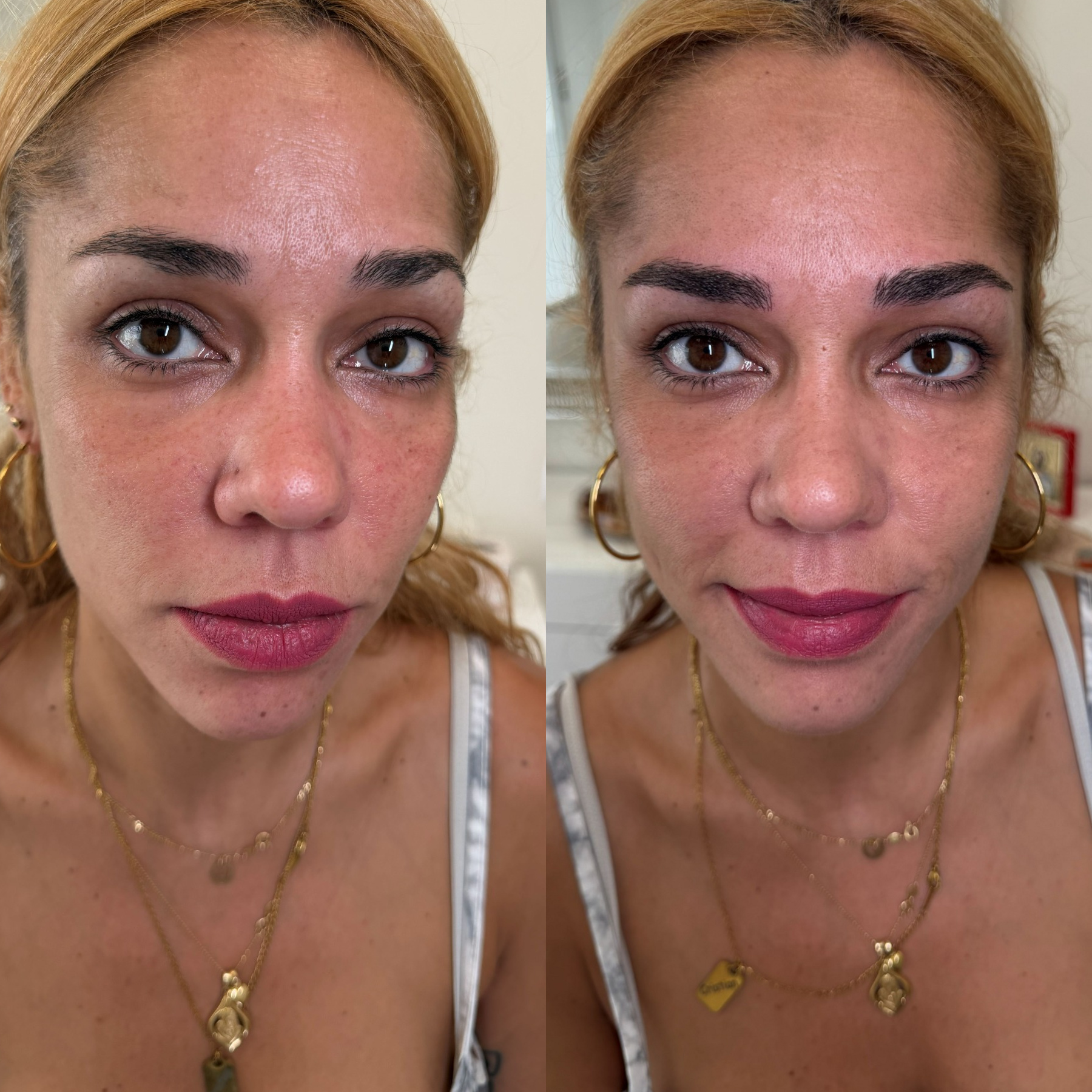 Antes y después micropigmentación de cejas, clienta 1