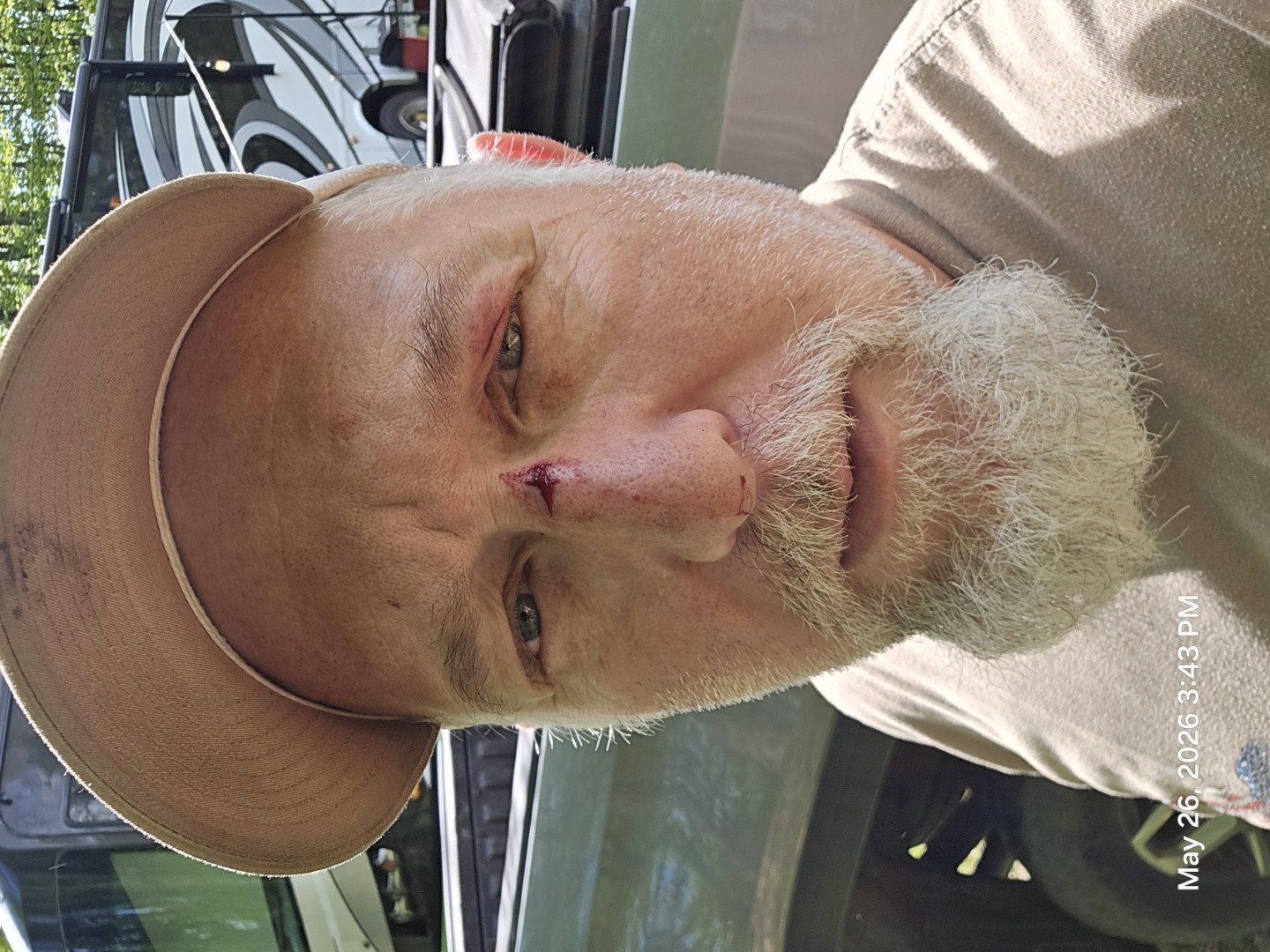 bruised and battered bruised and battered